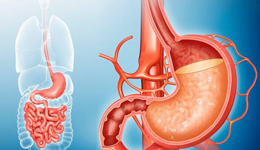 Can Stomach Ulcer Cause Diarrhoea 1 1024x591