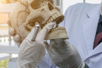 what is a bone graft